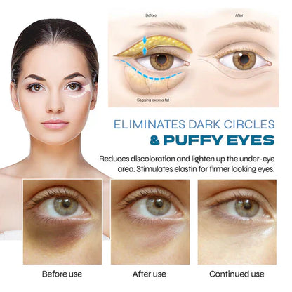 Zakdavi™ PEPTIDE Depuffing Eye Serum 🔥SALE 80% OFF 🔥