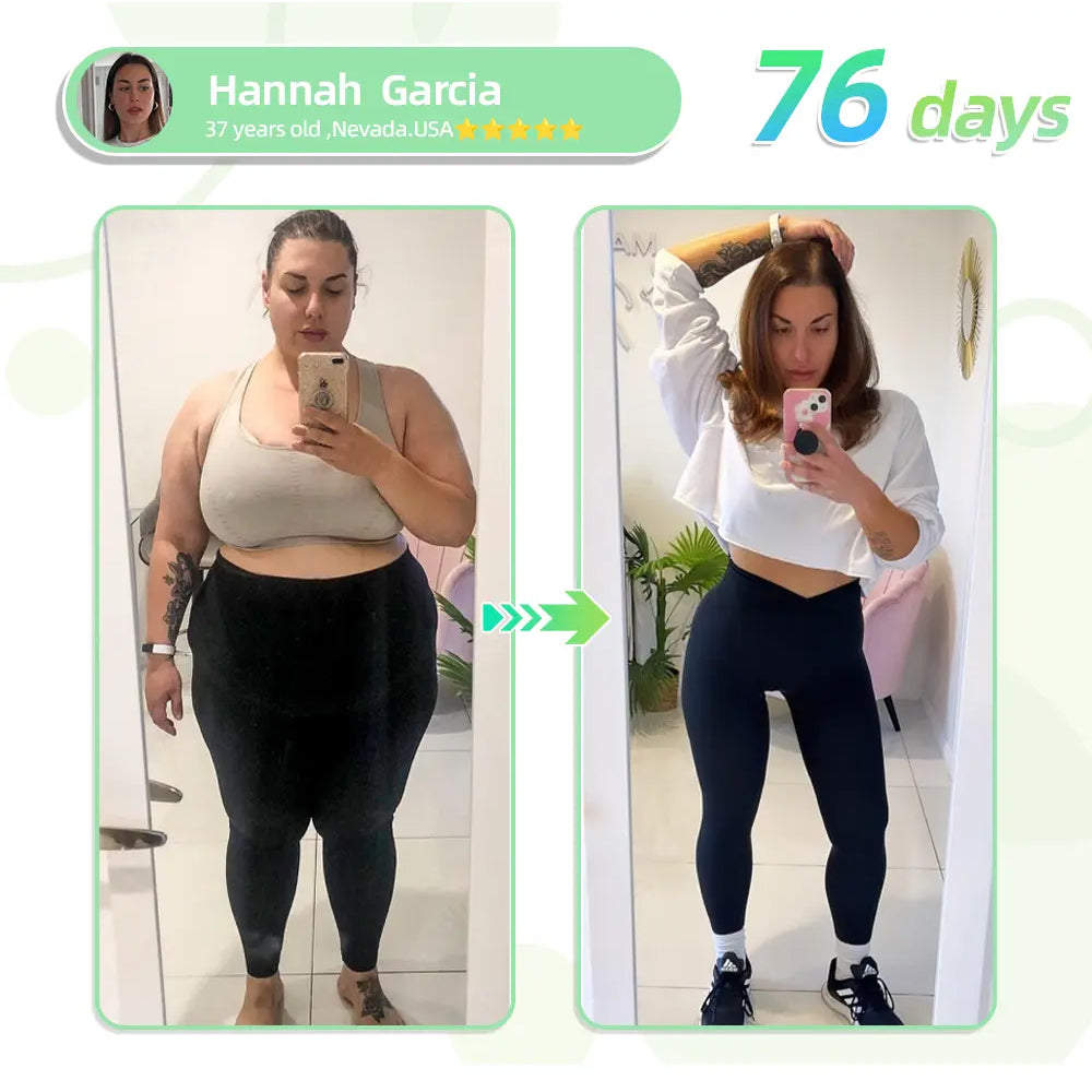 [See results in 7 days] ✅NEGUSY™ SMGT-GLP-1 Nano Microneedle Patch ✅ FDA certified (Painless, long-lasting, addressing diabetes, obesity, and cardiovascular diseases) 🍀up