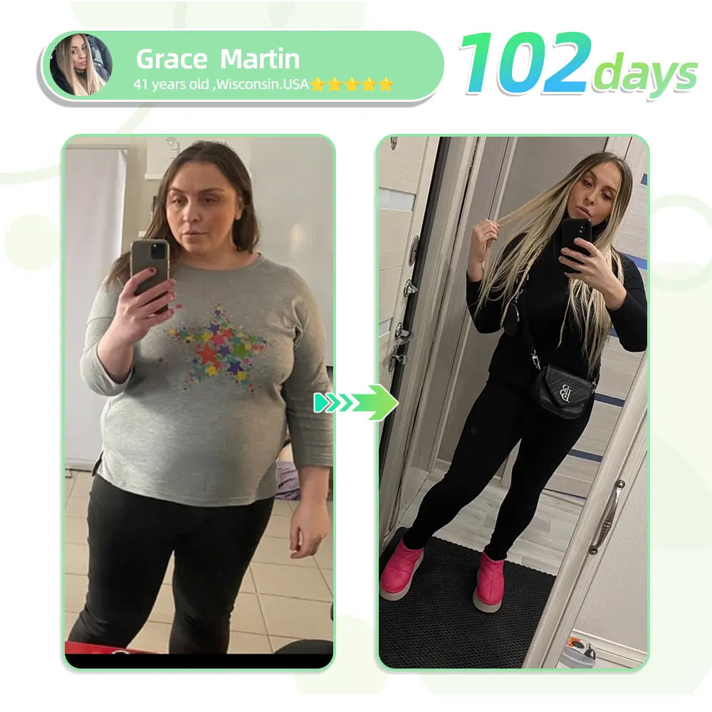 [See results in 7 days] ✅NEGUSY™ SMGT-GLP-1 Nano Microneedle Patch ✅ FDA certified (Painless, long-lasting, addressing diabetes, obesity, and cardiovascular diseases) 🍀up